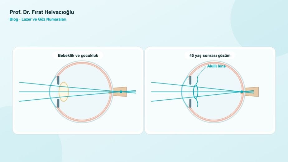 Hipermetroplar Hayat Boyu Nasıl Görür? – Prof. Dr. Fırat Helvacıoğlu