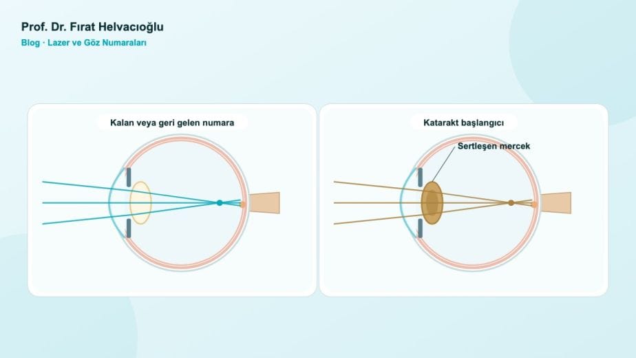 Lazerden Sonra Numara Geri Gelir mi? Tekrar Lazer Olunur mu? – Prof. Dr. Fırat Helvacıoğlu