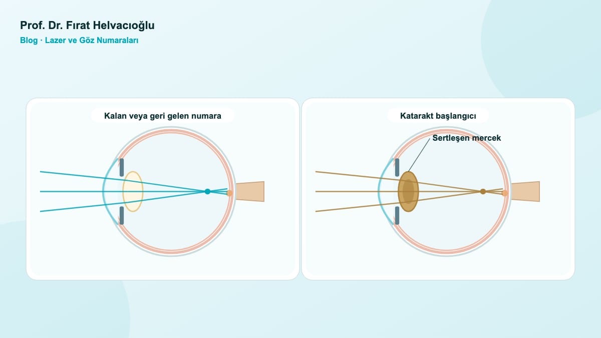 Lazerden Sonra Numara Geri Gelir mi? Tekrar Lazer Olunur mu? – Prof. Dr. Fırat Helvacıoğlu