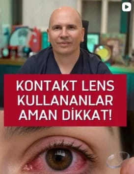 Prof. Dr. Fırat Helvacıoğlu: Kontakt lens kullananlar aman dikkat – Veni Vidi Göz Caddebostan, Kadıköy İstanbul göz doktoru