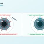 Is ogen laseren schadelijk?